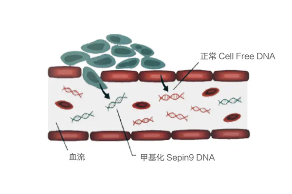 腸癌基因檢測領域 吉濤生物(wù)腫瘤全周期診斷有(yǒu)望解決臨床困局